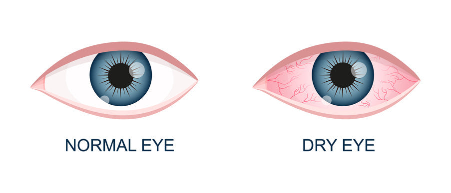 eyes