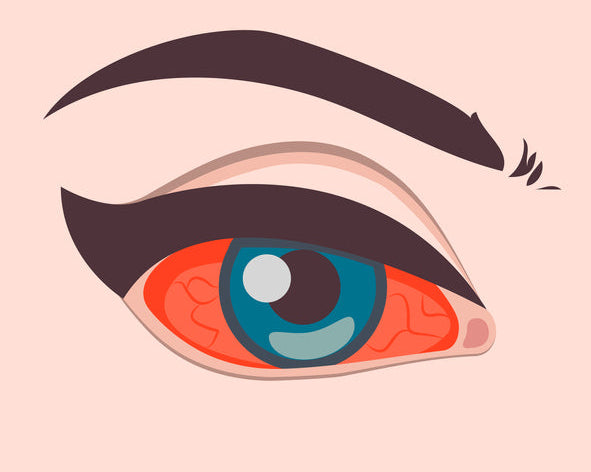 red eye