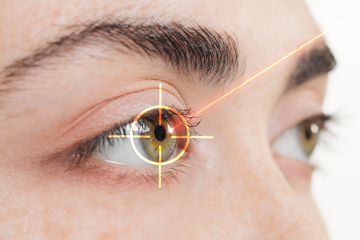 laser eye surgery