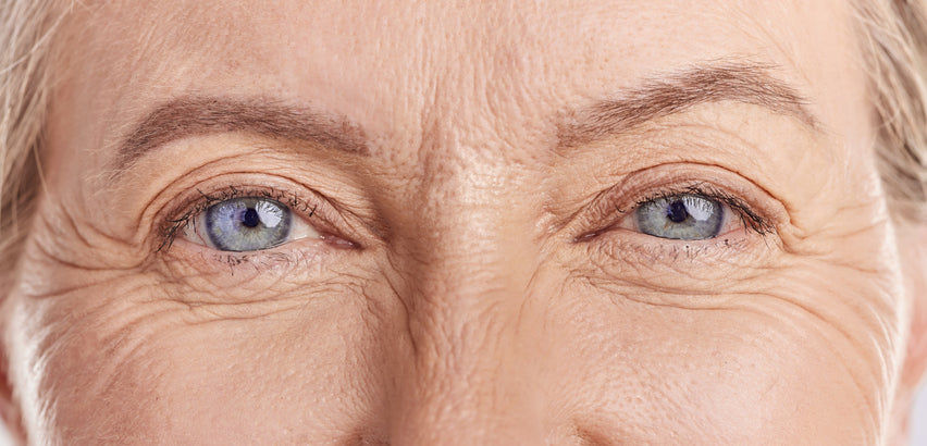woman with dry eyes