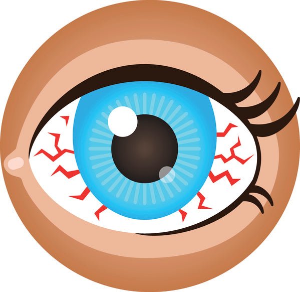 Dry Eye Syndrome - What Are the Causes and Cures for Dry Eye – Wizard Heated Eye Mask Blog