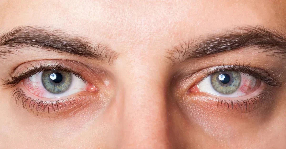 What is MGD? – Wizard Heated Eye Mask Blog